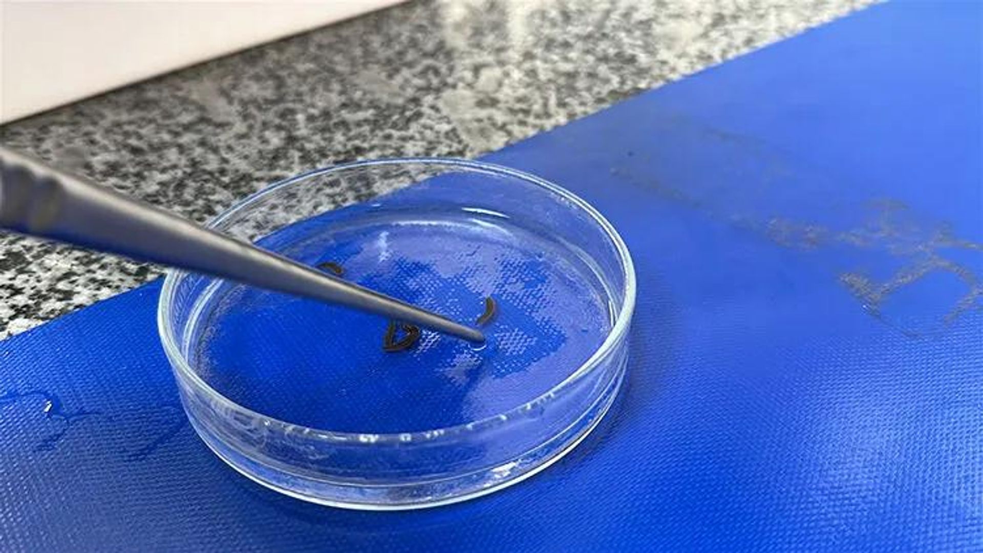 Boğazından canlı sülük çıkarıldı: 'Öğrenince biraz rahatladım, çoğalırsa diye panik oldum'